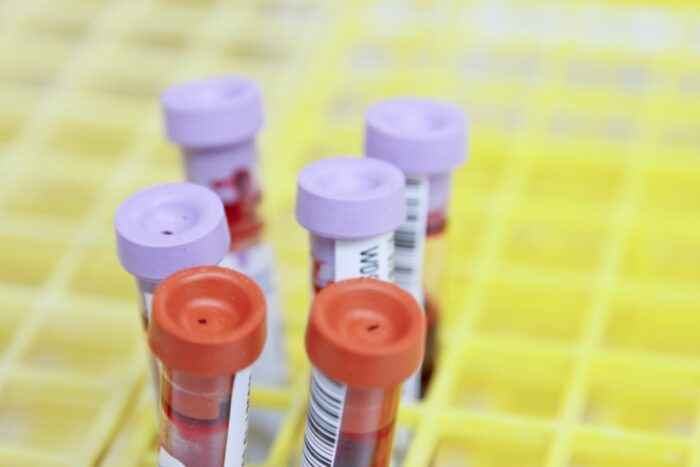 Clinical diagnostics laboratory category — photo by National Cancer Institute on Unsplash